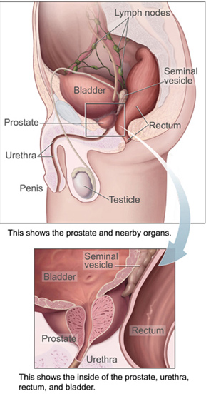 prostate-image
